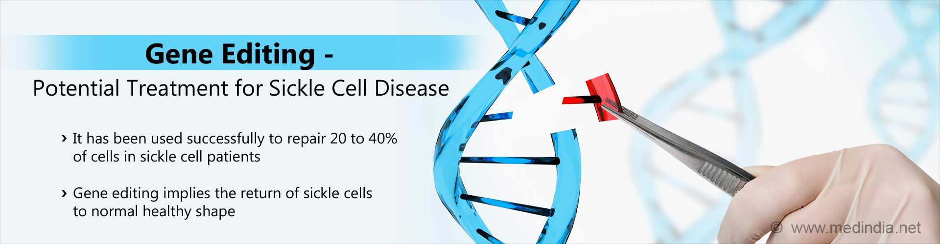 Gene Editing Treatment for Sickle Cell Disease