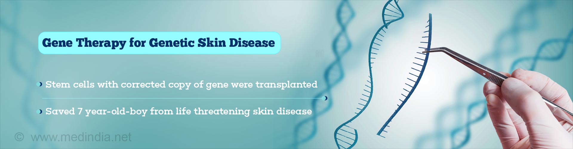 gene therapy for genetic skin disease
- stem cells with corrected copy of gene were transplanted
- saved 7 year-old-boy from life threatening skin disease