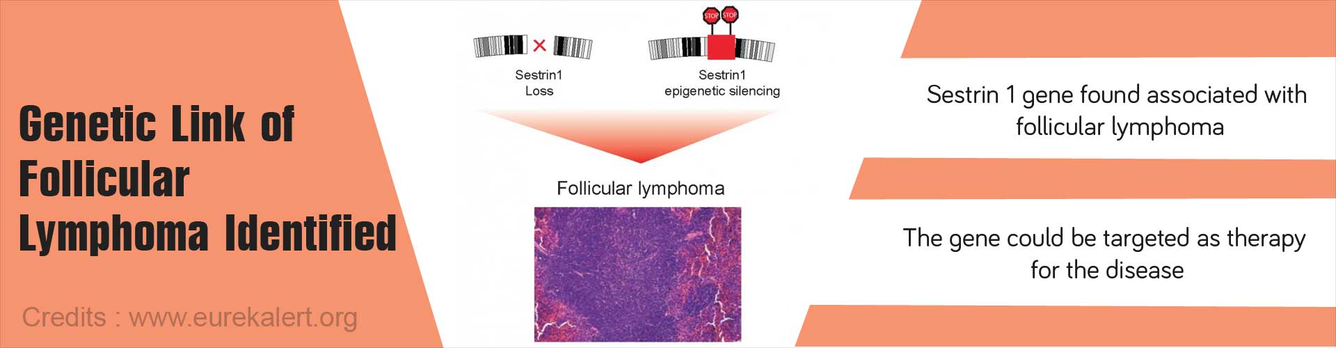 Genetic link of follicular lymphoma identified
- sestrin1 gene found associated with follicular lymphoma
- the gene could be targeted as therapy for the disease