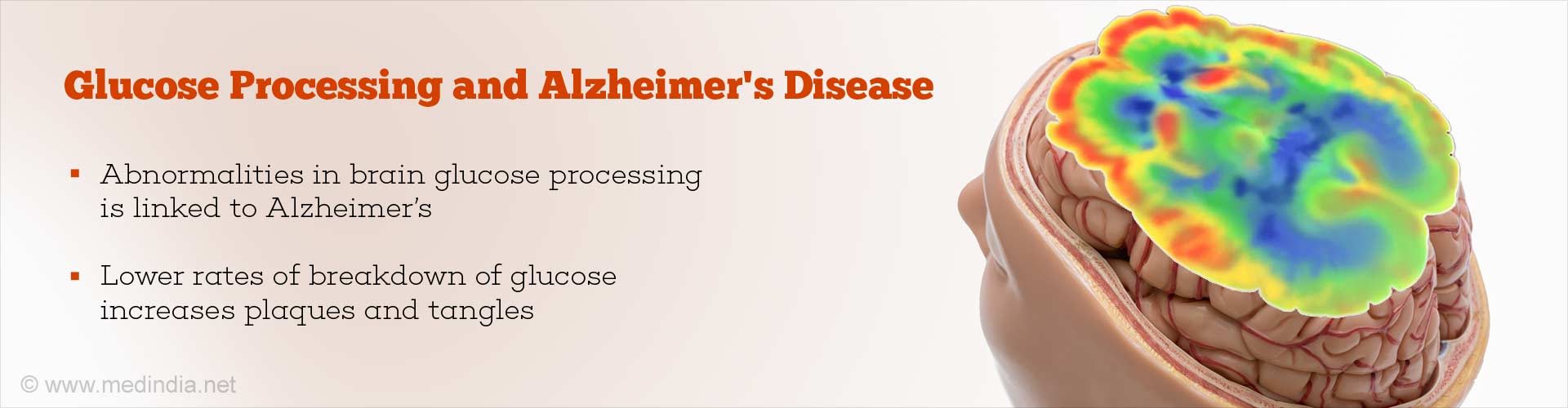 Glucose processing and Alzheimer's disease
- Abnormalities in brain glucose processing is linked to Alzheimer's
- Lower rates of breakdown of glucose increases plaques and tangles