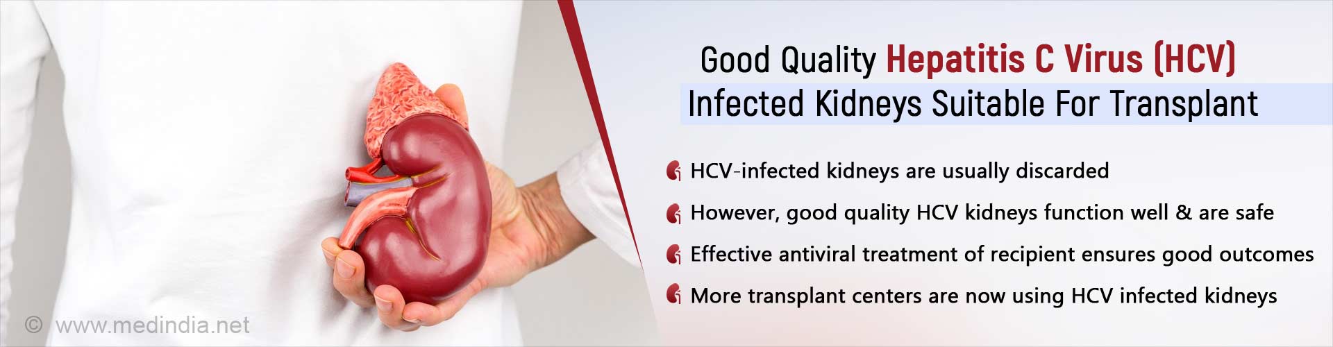 Good quality hepatitis C virus (HCV) infected kidneys suitable for transplant. HCV-infected kidneys are usually discarded. However, good quality HCV kidneys function well and are safe. Effective antiviral treatment of recipient ensures good outcomes. More transplant centers are now using HCV infected kidneys.