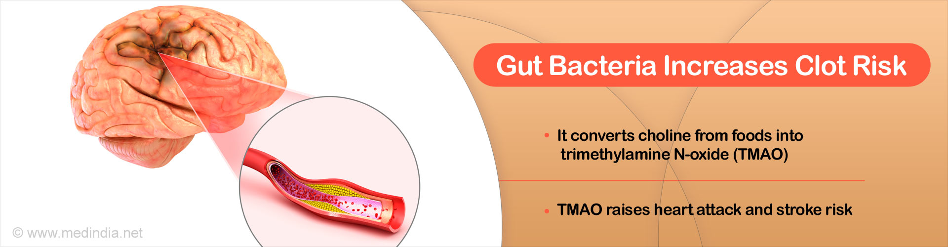 Gut bacteria increase clot risk
- It converts choline from foods into trimethylamine N-oxide (TMAO)
- TMAO raises heart attack and stroke risk