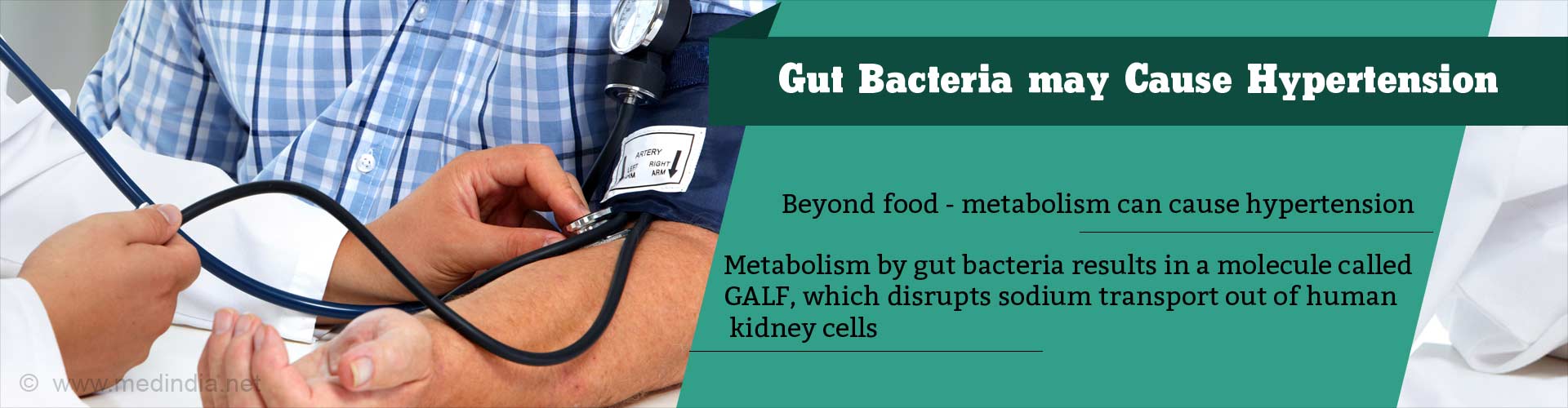 Gut Bacteria may cause Hypertension
- Beyond food - Metabolism can cause hypertension
- Metabolism by gut bacteria results in a molecule calles GALF, which disrupts sodium transport out of human kidney cells