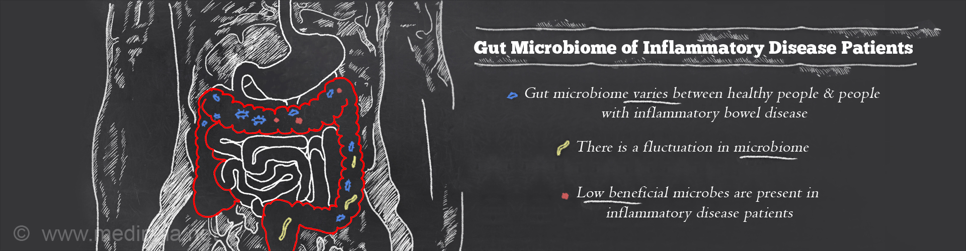 Gut Microbiome of Inflammatory Disease Patients

- Gut microbiome varies between healthy people & people with Inflammatory Bowel Disease
- There is a fluctuation in microbiome
- Low beneficial microbes are present in inflammatory disease patients