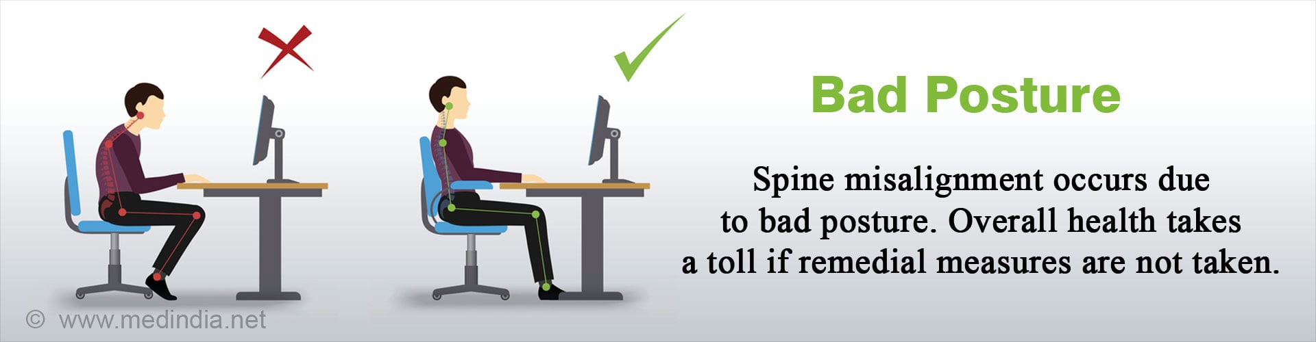 Bad Posture - Spine misalignment occurs due to bad posture. Overall health takes a toll if remedial measures are not taken.