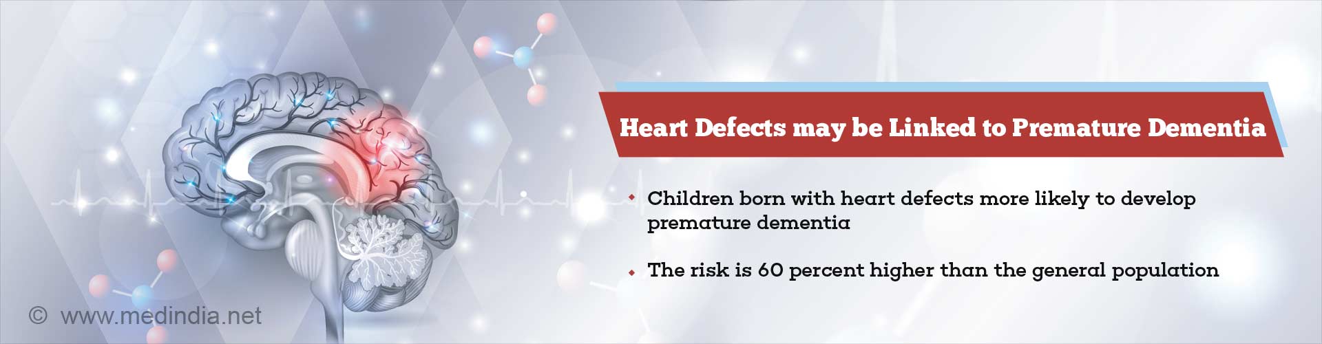 heart defects may be linked to premature dementia
- children born with heart defects more likely to develop premature dementia
- the risk is 60 percent higher than the general population