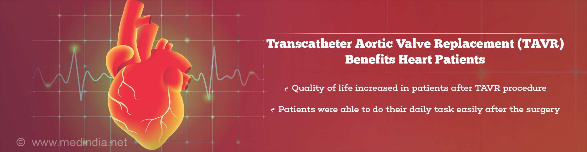 Transcatheter Aortic Valve Replacement (TAVR) Benefits Heart Patients