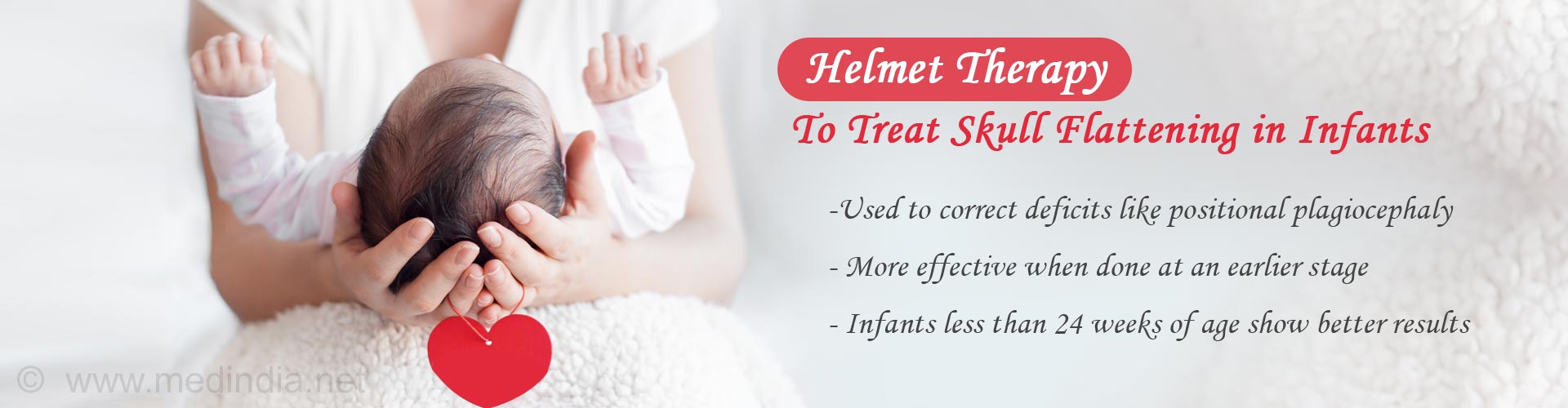 Helmet Therapy for Better Results in Infants With Skull Flattening