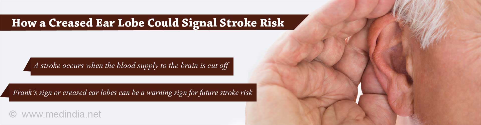How a Creased Ear Lobe Could Signal Stroke Risk
- A stroke occurs when the blood supply to the brain is cut off
- Frank''s sign or creased ear lobes can be a warning sign for future stroke risk