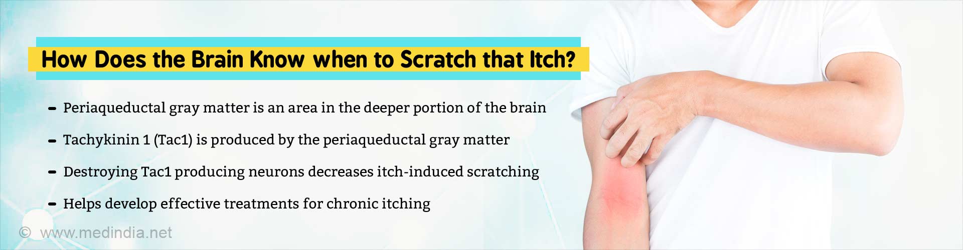 How does the brain know when to scratch that itch? Periaqueductal gray matter is an area in the deeper portion of the brain. Tachykinin 1 (Tac1) is produced by the periaqueductal gray matter. Destroying Tac1 producing neurons decreases itch-induced scratching. Helps develop effective treatments for chronic itching.