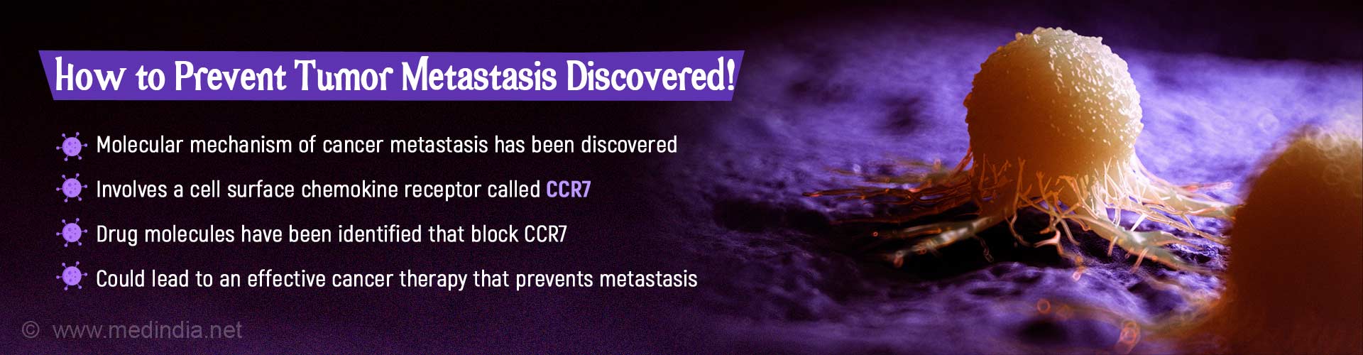 How to prevent tumor metastasis discovered. Molecular mechanism of cancer metastasis has been discovered. Involves a cell surface chemokine receptor called CCR7. Drug molecules have been identified that block CCR7. Could lead to an effective cancer therapy that prevents metastasis.