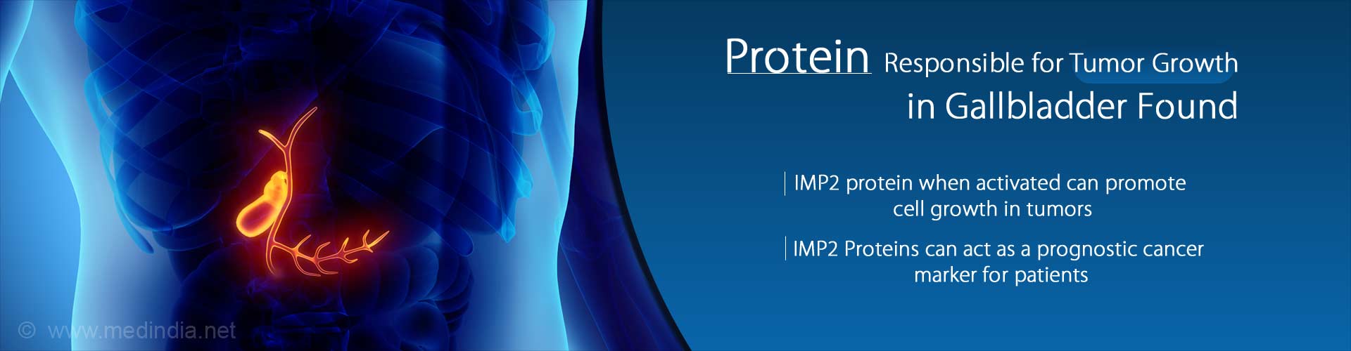 Protein responsible for tumor growth in gallbladder found
- IMP2 protein when activated can promote cell growth in tumors
- These proteins can help predict the outcomes after the cancer treatment
- IMP2 proteins can act as a prognostic cancer marker for patients