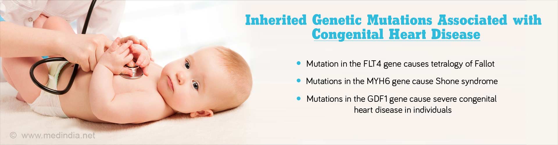 Inherited genetic mutations associated with congenital heart disease
- Mutation in the FLT4 gene causes tetralogy of fallot
- Mutations in the MYH6 genes causes Shone syndrome
- Mutations in the GDF1 genes cause severe congenital heart disease in individuals