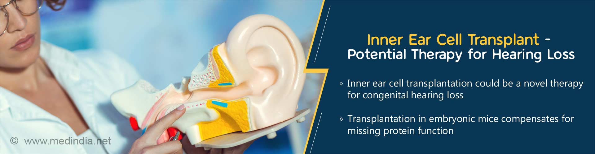 inner ear cell transplant - potential therapy for hearing loss
- inner ear cell transplantation could be a novel therapy for congenital hearing loss
- transplantation in embryonic mice compensates for missing protein function