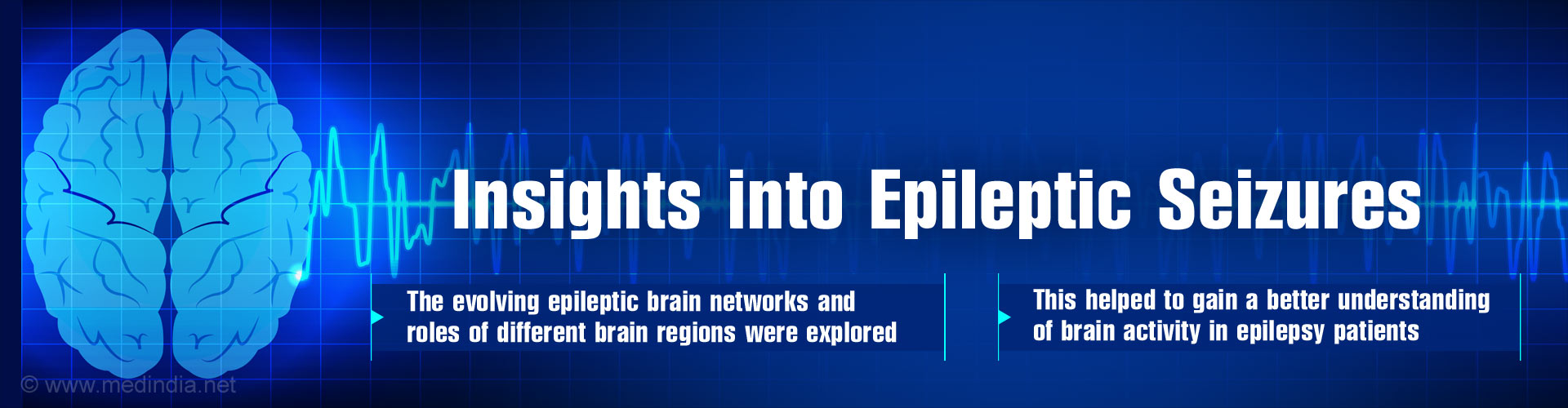 Insights into epileptic seizures
- The evolving epileptic brain networks and roles of different brain regions were explored
- This helped to gain a better understanding of brain activity in epilepsy patients
