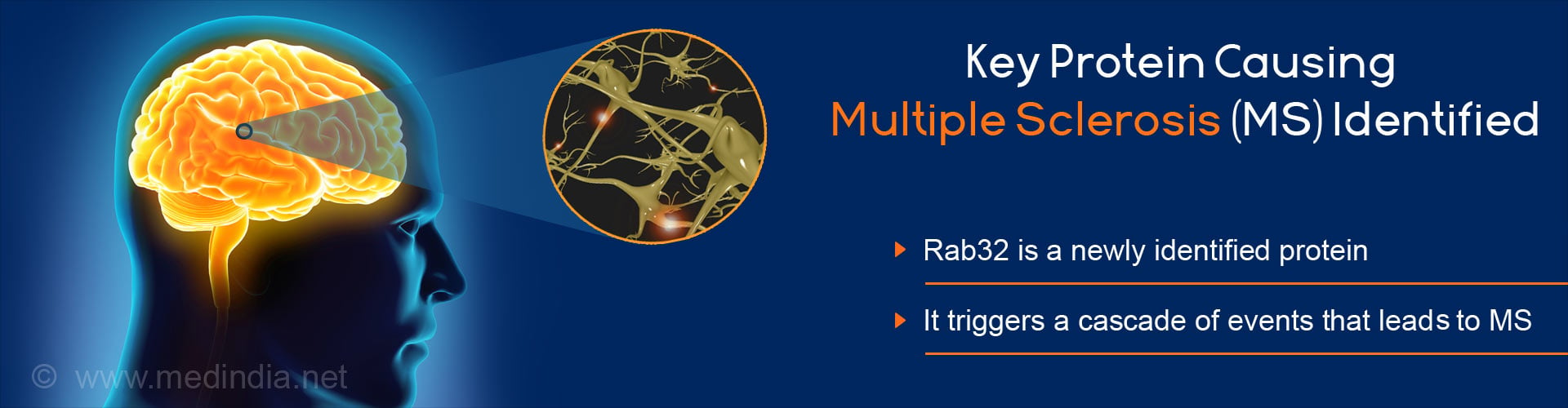 Key protein causing multiple sclerosis(ms) identified
- Rab32 is a newly identified protein
- It triggers a cascade of event that leads to ms