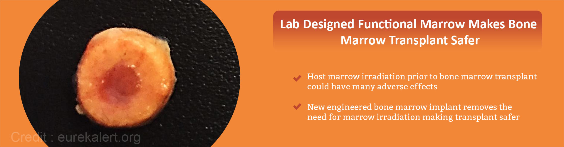 Lab designed functional marrow makes bone marrow transplant safer
- Host marrow irradiation prior to bone marrow transplant could have many adverse effects
- New engineered bone marrow implant removes the need for marrow irradiation making transplant safer