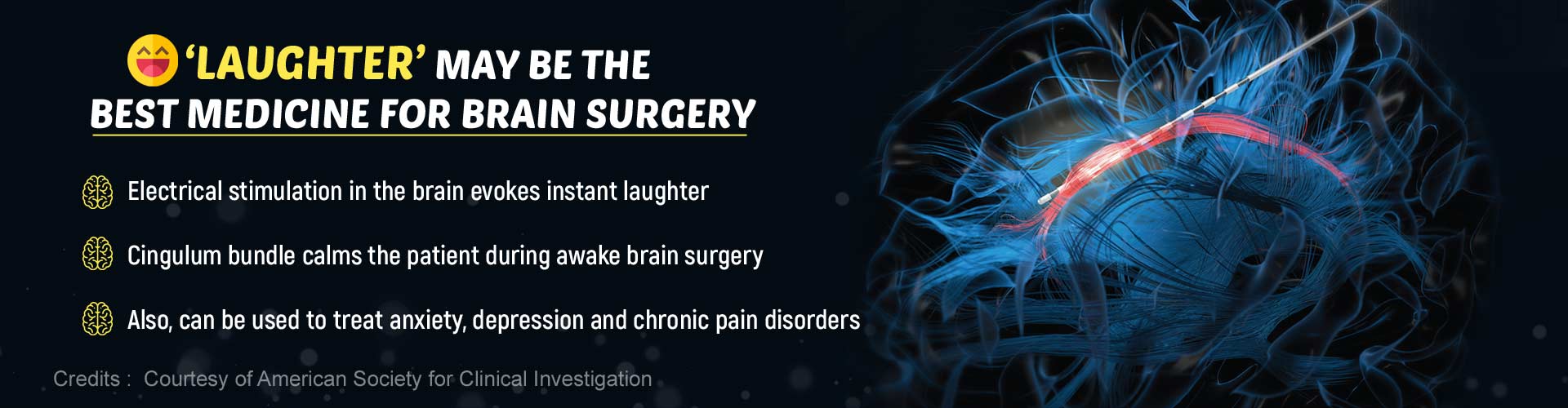 Laughter may be the best medicine for brain surgery. Electrical stimulation in the brain evokes instant laughter. Cingulum bundle calms the patient during awake brain surgery. Also, can be used to treat anxiety, depression and chronic pain disorders.