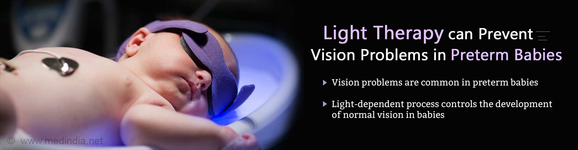 Light therapy can prevent vision problems in preterm babies. Vision problems are common in preterm babies. Light-dependent process controls the development of normal vision in babies.