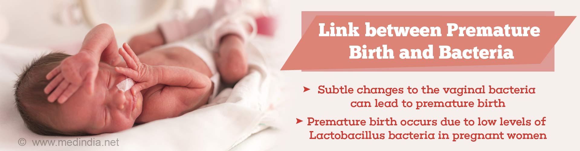 link between premature birth and bacteria
- subtle changes to the vaginal bacteria can lead to premature birth
- premature birth occurs due to low levels of lactobacillus bacteria in pregnant women