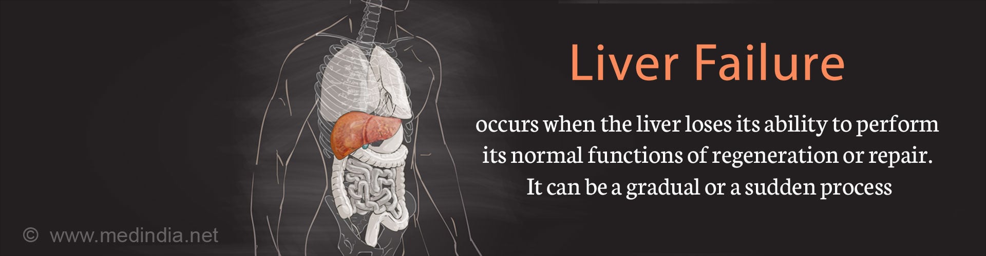 Liver failure occurs when the liver loses its ability to perform its normal functions of regeneration or repair. It can be a gradual or sudden process.