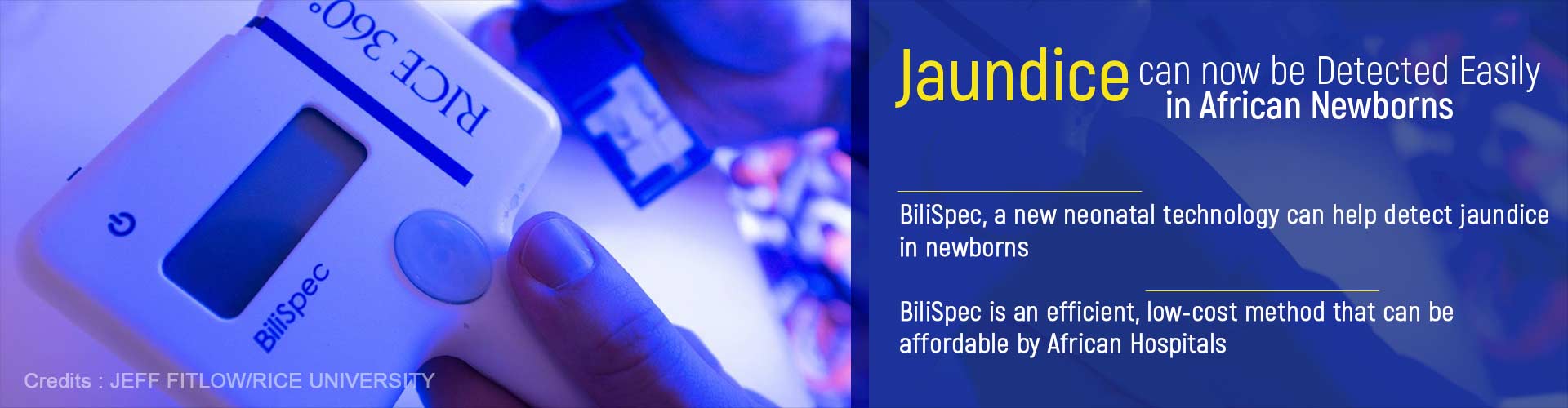 Jaundice can now be detected easily in African newborns
- BiliSpec, a new neonatal technology can help detect jaundice in newborns
- BiliSpec is an efficient, low-cost method that can be affordable by African Hospitals