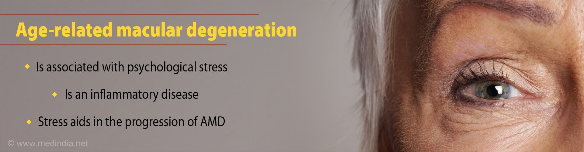 Age-related macular degeneration
- Is associated with psychological stress
- Is an inflammatory disease
- Stress aids in the progression of AMD