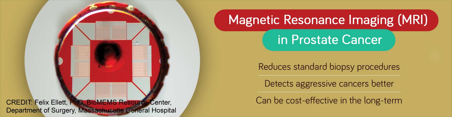 magnetic resonance imaging (MRI) in prostate cancer
- reduces standard biopsy procedures
- detects aggressive cancers better
- can be cost-effect in the long-term