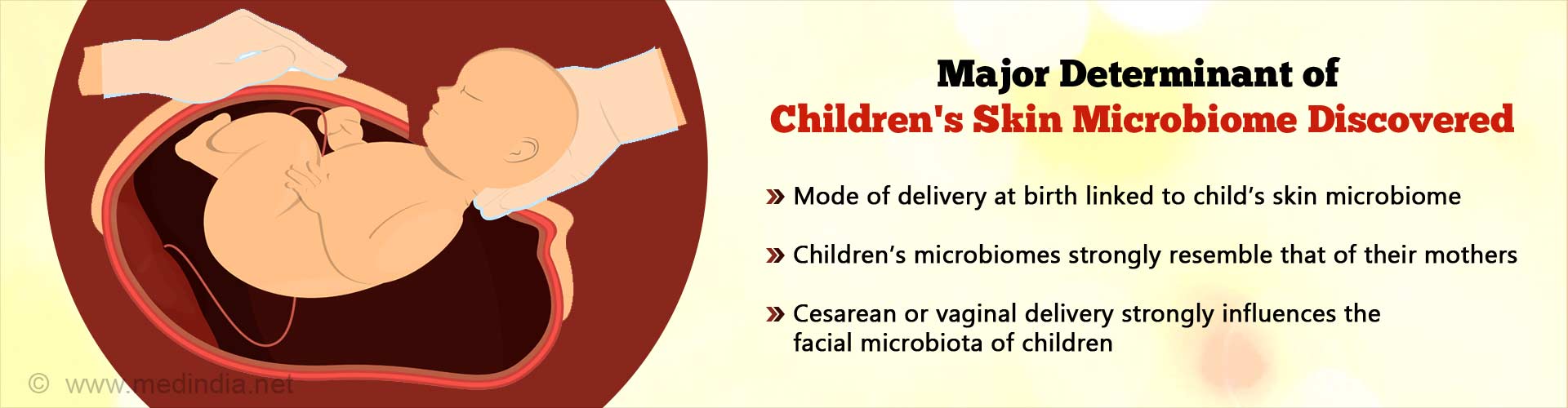 发现儿童皮肤微生物群的主要决定因素。出生时的分娩方式与孩子的皮肤微生物群有关。儿童的微生物群与母亲非常相似。剖宫产或阴道分娩强烈影响儿童面部微生物群。