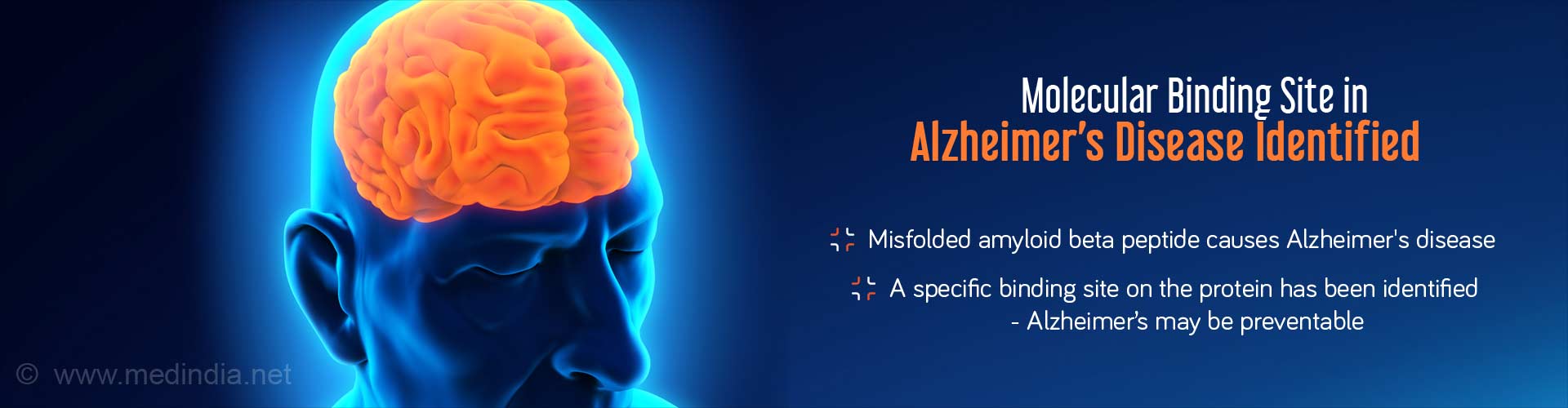 Molecular binding site in Alzheimer's disease identified
- Misfolded amyloid beta peptide causes Alzheimer's disease
- A specific binding site on the protein has been identified
- Alzheimer's may be prevented