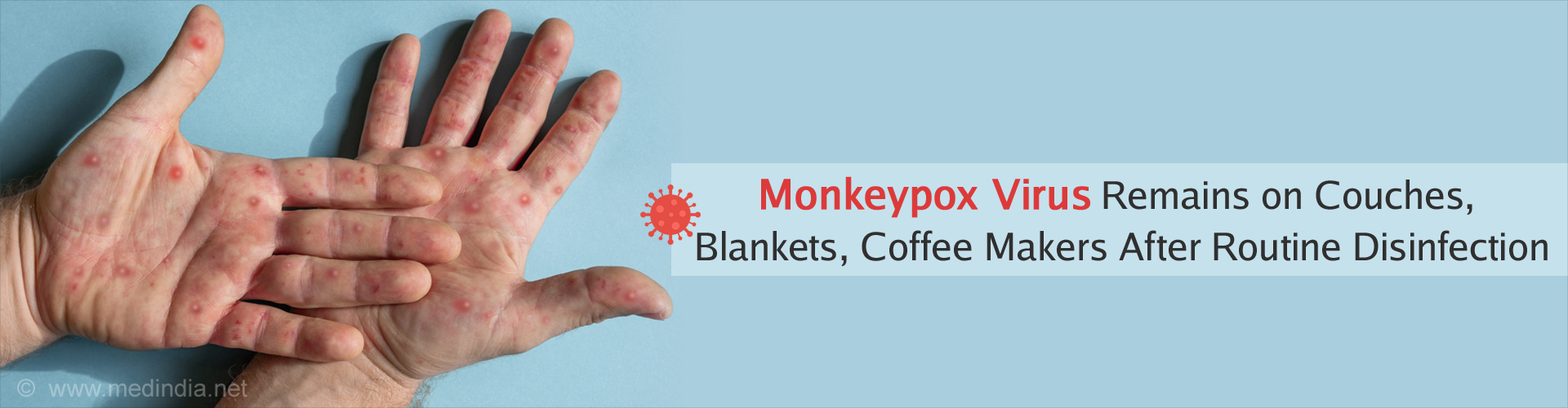 How Long Does Monkeypox Virus Stay on Household Surfaces? Health Tips
