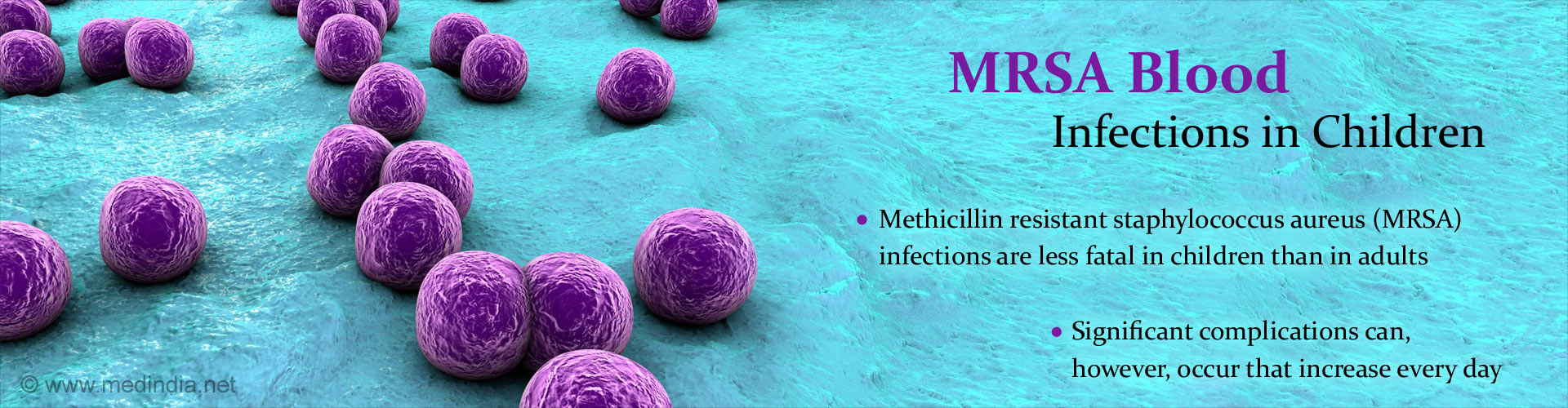 MRSA Blood Infections in Children
- Methicillin resistant staphyloccus aureus (MRSA) infections are less fatal in children than in adults
- Significant complications can, however occur that increase every day