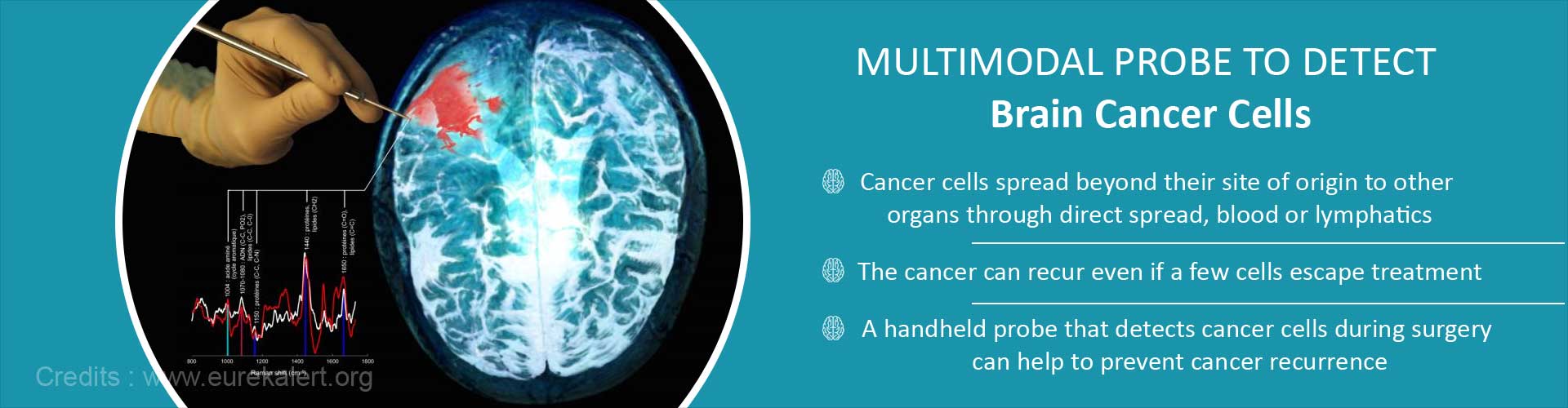 Multimodal probe to detect brain cancer cells
- Cancer cells spread beyond their site of origin to other organs through direct spread, blood or lymphatics
- The cancer can recur even if a few cells escape treatment
- A handheld probe that detects cancer cells during surgery can help to prevent cancer recurrence