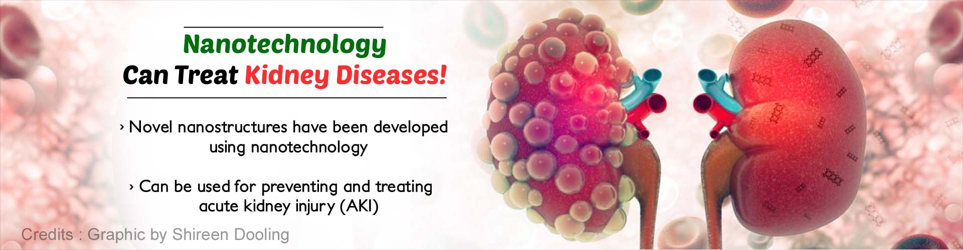 Nanotechnology can treat kidney diseases. Novel nanostructures have been developed using nanotechnology. Can be used for preventing and treating acute kidney injury (AKI).