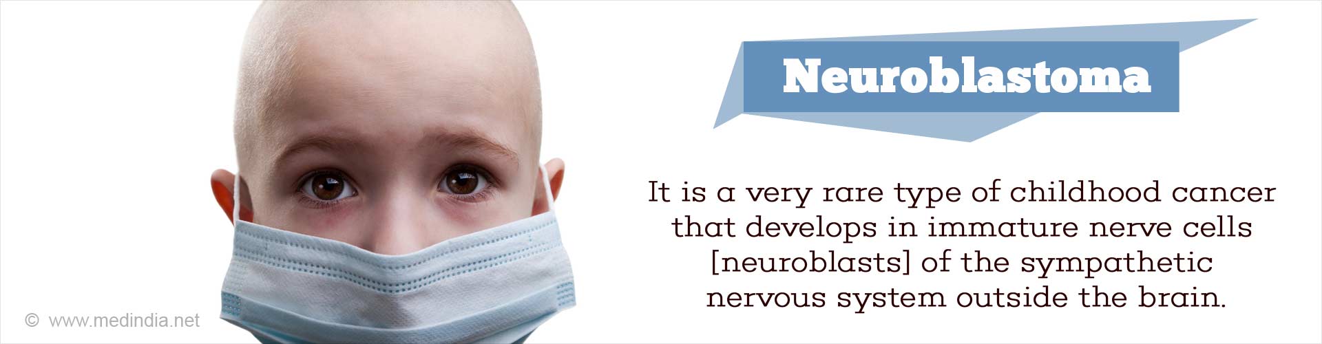 Neuroblastoma - It is a very rare type of childhood cancer that develops in immature nerve cells (neuroblasts) of the sympathetic nervous system outside the brain.