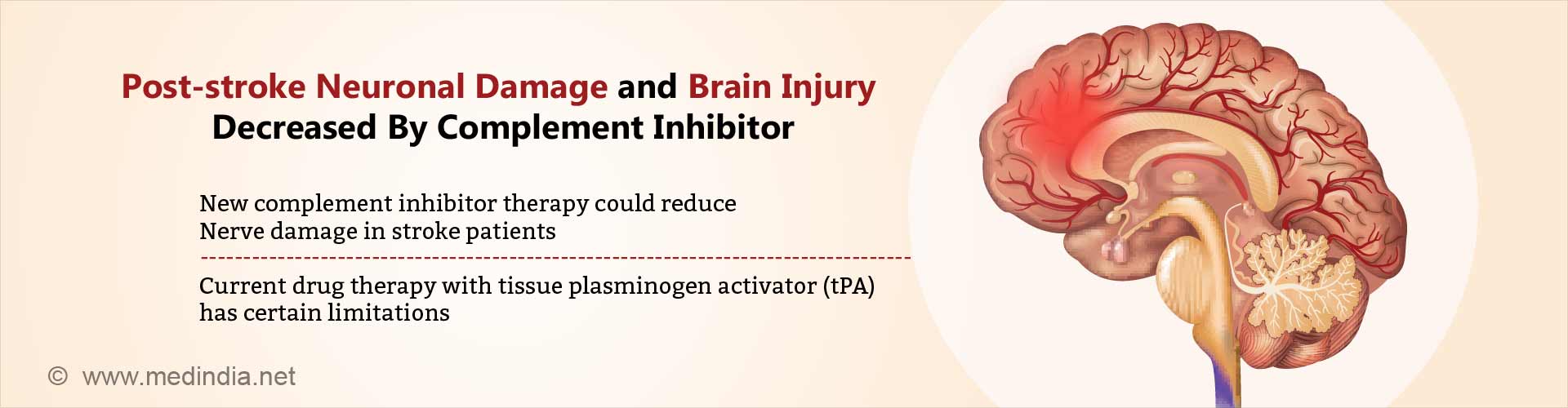 post-stroke neuronal damage and brain injury decreased by complement inhibitor
- new complement inhibitor therapy could reduce nerve damage in stroke patients
- current drug therapy with tissue plasminogen activator (tPA) has certain limitations