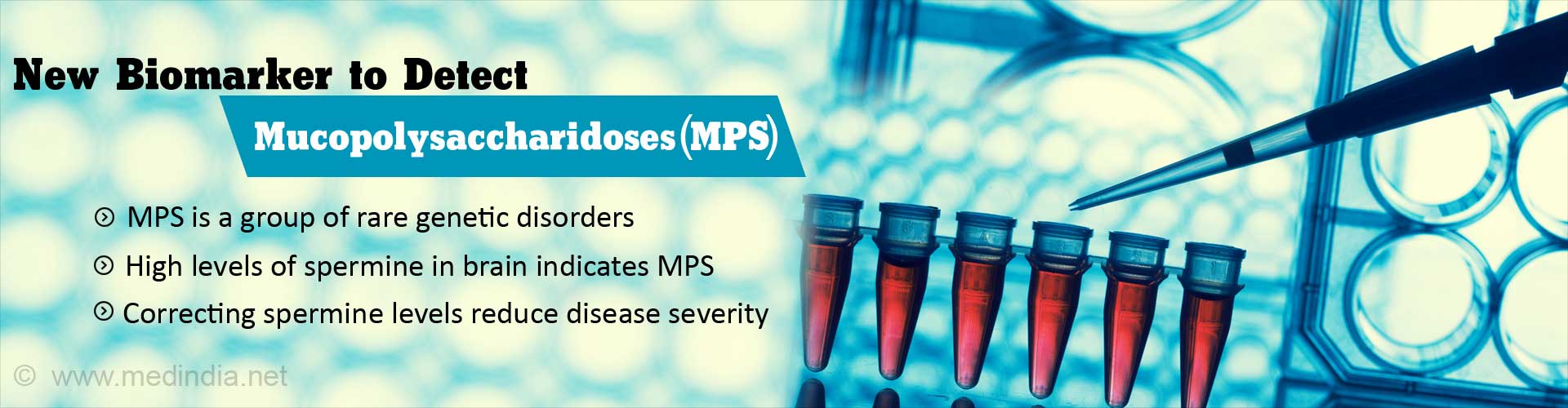New biomarker to detect mucopolysaccharidoses (MPS)
- MPS is a group of rare genetic disorders
- High levels of spermine in brain indicates MPS
- Correcting spermine levels reduce disease severity