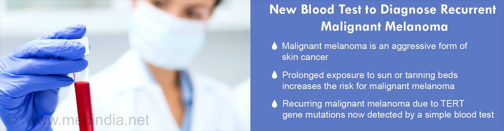 New Blood Test to Diagnose Recurrent Malignant Melanoma
- Malignant melanoma is an aggressive form of skin cancer
- Prolonged exposure to sun or tanning beds increases the risk for malignant melanoma
- Recurring malignant melanoma due to TERT gene mutatuions now detected by a simple blood test