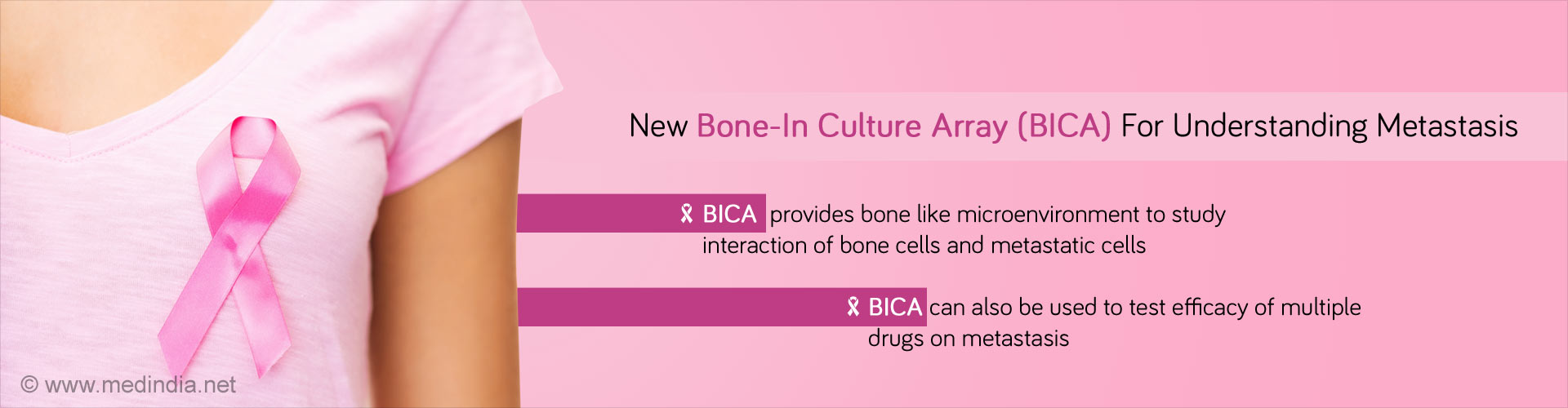 New bone-in culture array (BICA) for understanding metastasis
- BICA provides bone like micro-environment to study interaction of bone cells and metastasic cells
- BICA can also be used to test efficacy of multiple drugs on metastasis