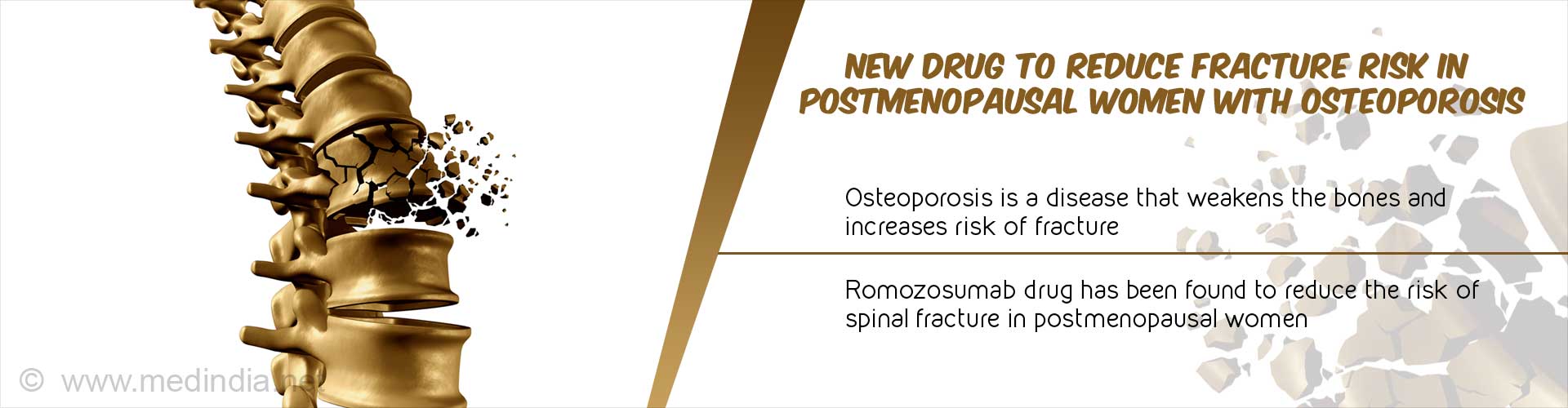 New drug to reduce fracture risk in postmenopausal women with osteoporosis
- Osteoporosis is a disease that weakens the bones and increases risk of fracture
- Romozosumab drug has been found to reduce the risk of spinal fracture in postmenopausal women
