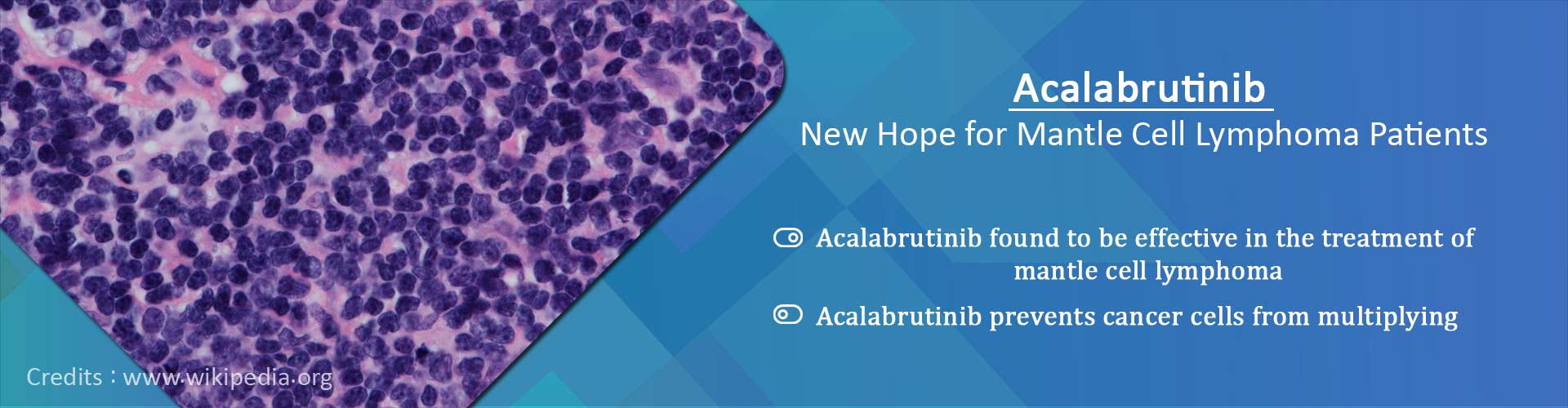 Acalabrutinib - new hope for mantle cell lymphoma patients
- Acalabrutinib found to be effective in the treatment of mantle cell lymphoma
- Acalabrutinib prevents cancer cells from multiplying
