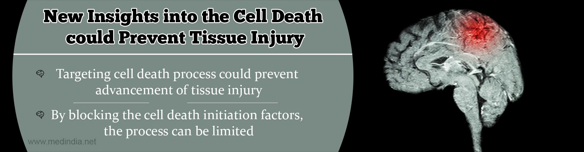 New Insights into the Cell Death could Prevent Tissue Injury
- Targeting cell death process could prevent advancement of tissue injury
- By blocking the cell death initiation factors, the process can be limited