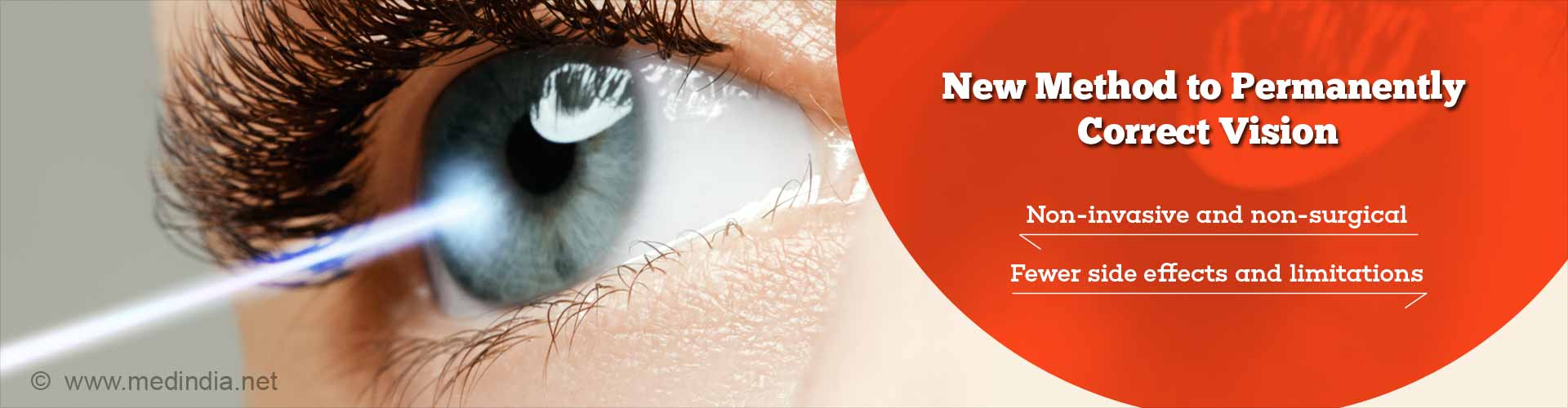 New Method to Permanently Correct Vision