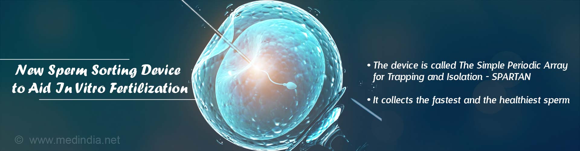 new sperm sorting device to aid in vitro fertilization
- the device is called ''the simple periodic array for trapping and isolation'' - SPARTAN
- it collects the fastest and the healthiest sperm