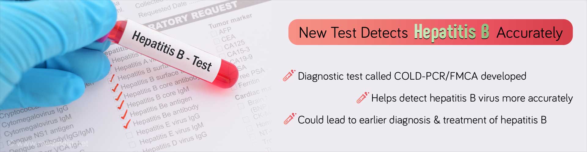 New test detects hepatitis B accurately. Diagnostic test called COLD-PCR/FMCA developed. Helps detect hepatitis B virus more accurately. Could lead to earlier diagnosis & treatment of hepatitis B.
