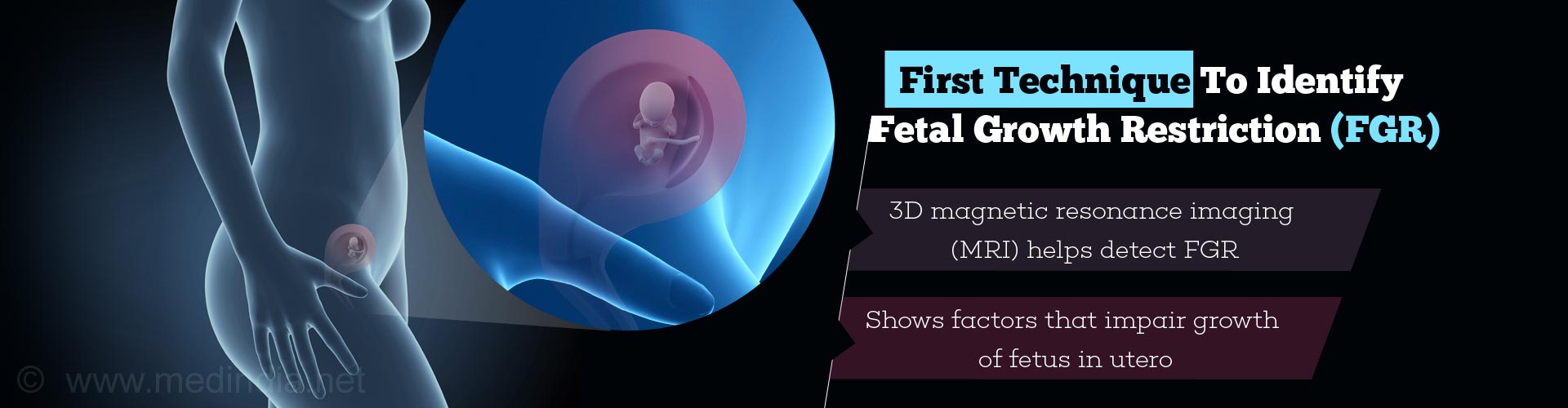 first technique to identify fetal growth restriction (fgr)
- 3D magnetic resonance imaging (MRI) helps detect FGR
- shows factors that impair growth of fetus in utero