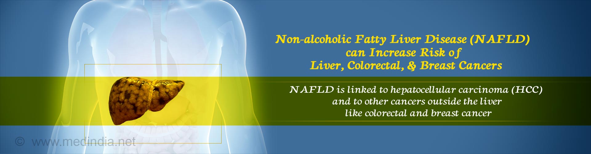 non-alcoholic fatty liver disease (NAFLD) can increase risk of liver, colorectal & breast cancers
- NAFLD is linked to hepatocellular carcinoma (HCC) and to other cancers outside the liver like colorectal and breast cancer
