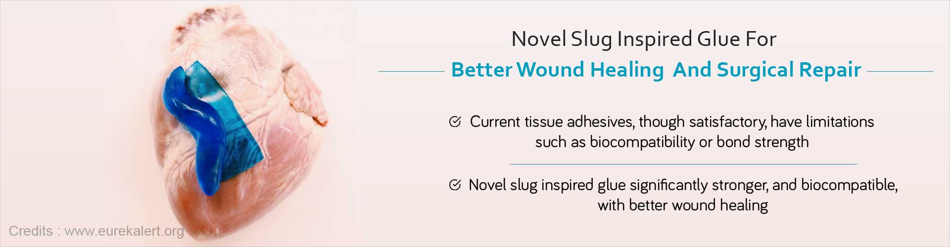 Novel Slug Inspired Glue for Better Wound Healing and Surgical Repair
- Current tissue adhesives, though satisfactory, have limitations such as biocompatibility or bond strength
- Novel slug inspired glue significantly stronger, and bio compatible, with better wound healing
