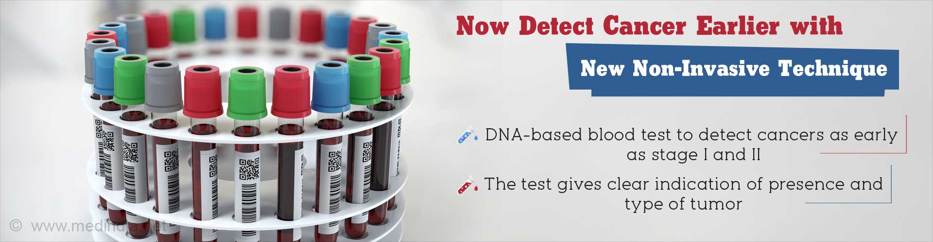 now detect cancer earlier with new non-invasive technique
- DNA-based blood test to detect cancers as early as stage I and II
- the test gives clear indication of presence and type of tumor