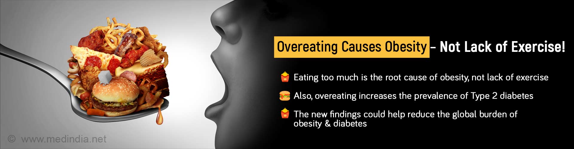 Overeating Causes Obesity, Not Lack of Exercise. Eating too much is the root cause of obesity, not lack of exercise. Also, overeating increases the prevalence of Type 2 diabetes. The new findings could help reduce the global burden of obesity and diabetes. 
